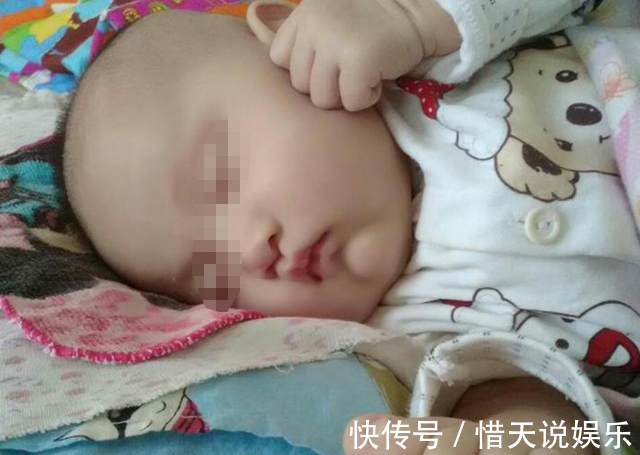 男宝|宝妈剖腹产下龙凤胎,出产房时却只看到男宝,知道原因后悲痛欲绝