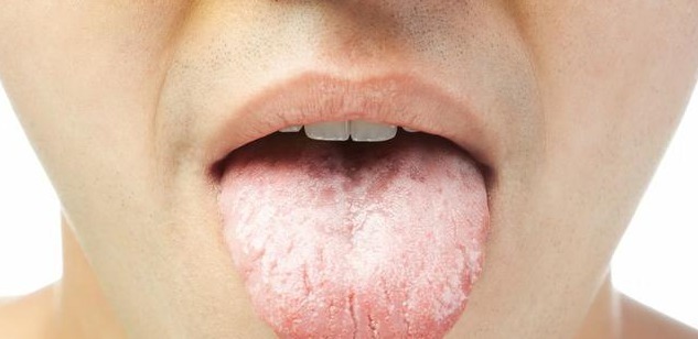 湿气|天然的“祛湿王”,每天来1杯,湿气排得一干二净,体重也轻了