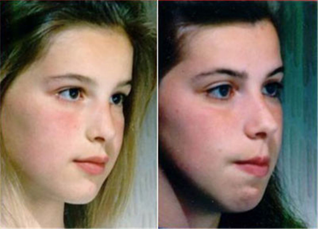 洛洛|除了张嘴睡觉，还有四个用嘴习惯会降低颜值，快看你家孩子有没有