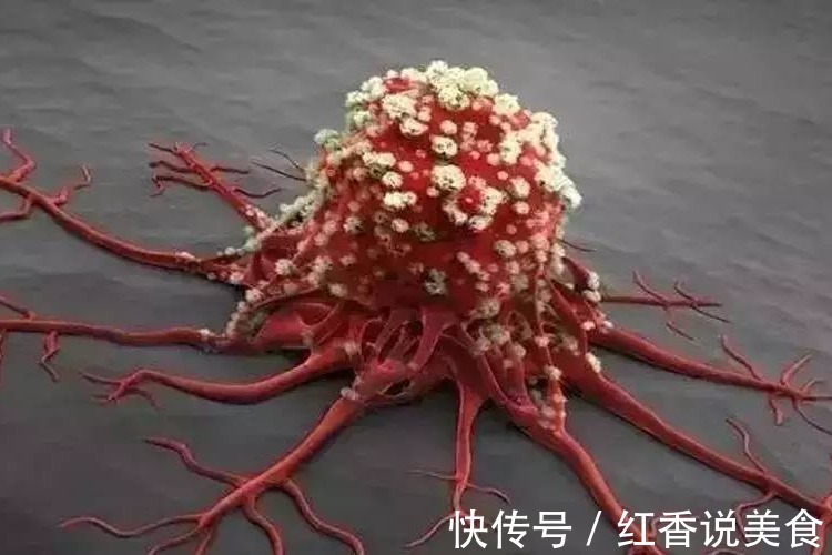 复发|聂卫平抗癌8年至今无复发,从癌症晚期到肿瘤消失,2件事是关键