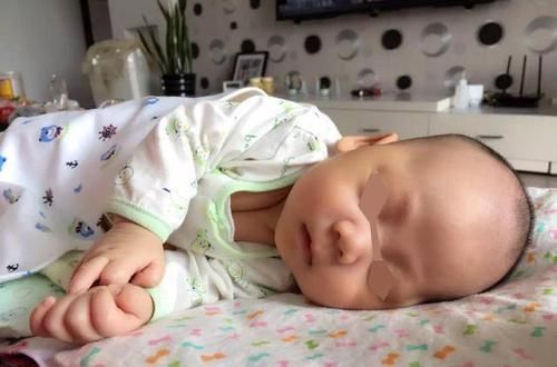 枕头|孩子刚出生就给枕枕头，导致头型太难看，医生询问原因后无奈摇头
