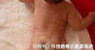 宝宝|为什么有些刚出生的小孩子屁股上有青胎印?