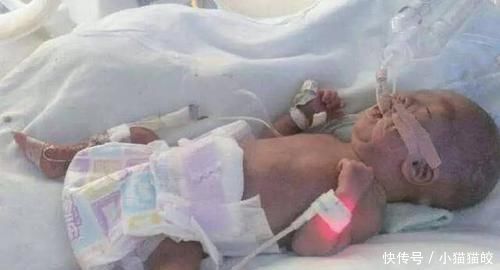 这种血型的妈妈建议只生一个,否则二胎可能引起“新生儿溶血症”