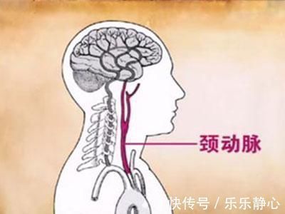 斑块|老年人是不是都会长颈动脉斑块?要紧吗?该咋办?