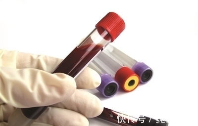 总胆固醇|高血脂的人适合做什么运动？在起作用的时间上对运动有什么要求？