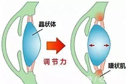 真性近视|家有近视娃的妈妈，这是你最不该错过的一篇文章