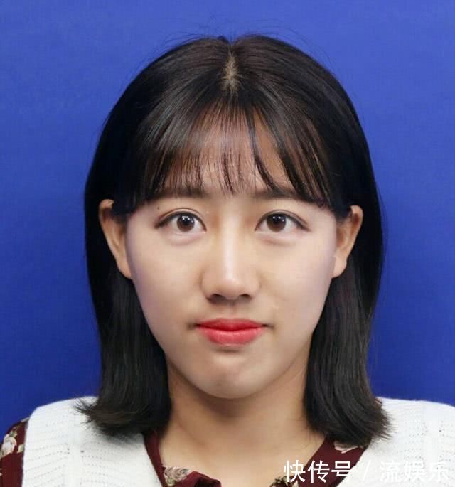 女生整容会被嫌弃吗只要没有这几点，整过之后还是很漂亮