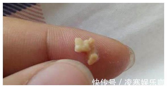 口腔|孩子因口气臭被同学排挤,送诊查检后,医生都没忍住恶心呕吐