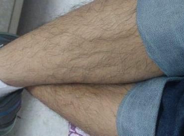 下肢浮肿|男性开始衰老,下肢会出现这些情况,如果没有说明还年轻