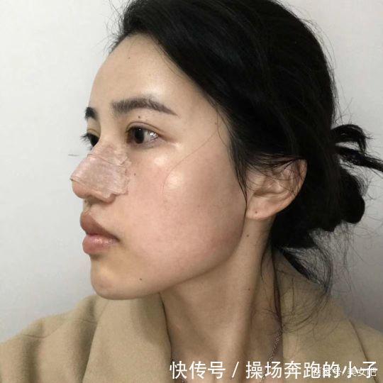 面部一枝花,全靠“鼻”当家