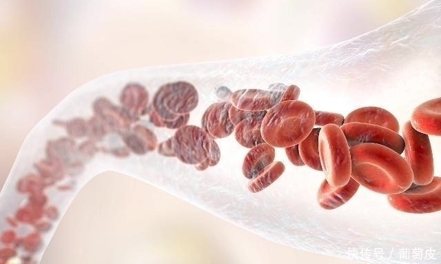 豆豉|血管洗个澡,健康活到老!3种餐桌上的“清道夫”,越吃越健康!