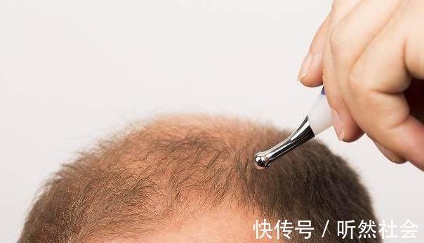 腰椎间盘|男性开始衰老的4种表现，中3个以上，别不承认，该好好保养了！