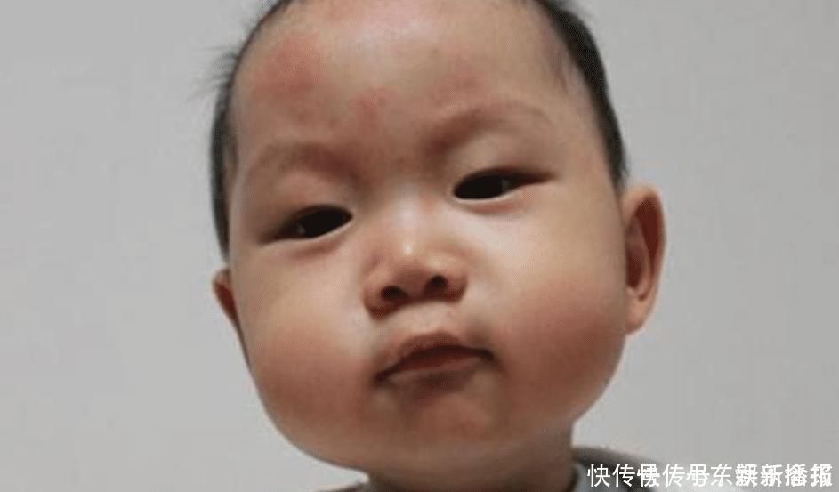 检查|一天一个鸡蛋，3岁宝宝吃出事了检查后发现，惹祸的不止是鸡蛋