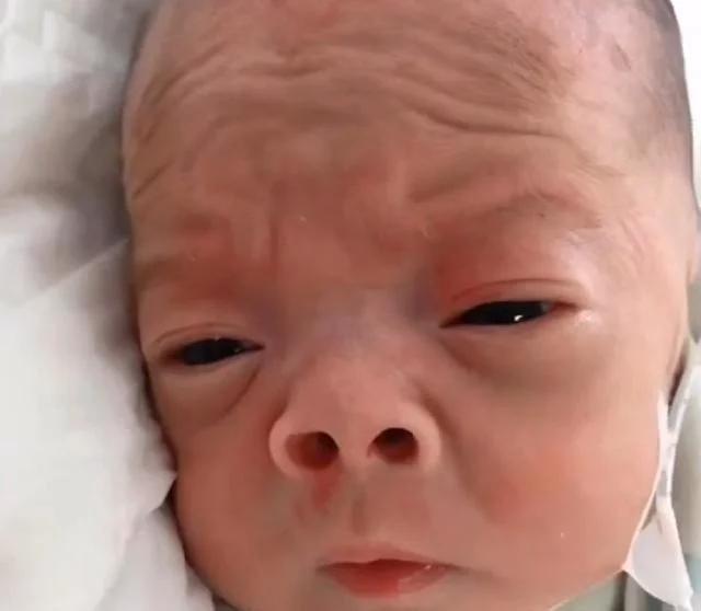 宝宝|还记得“丑哭宝妈”的网红宝宝吗?当初你嫌我丑,如今美到认不出