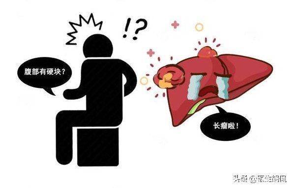 癌症|体内有癌,腹部早知,腹部若有3个“异常”,癌细胞或已“登门”