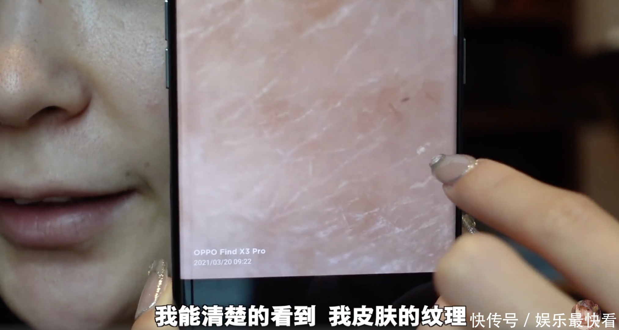 最近流行显微镜皮肤缺水测试？比美容院仪器还好使！直观又省钱