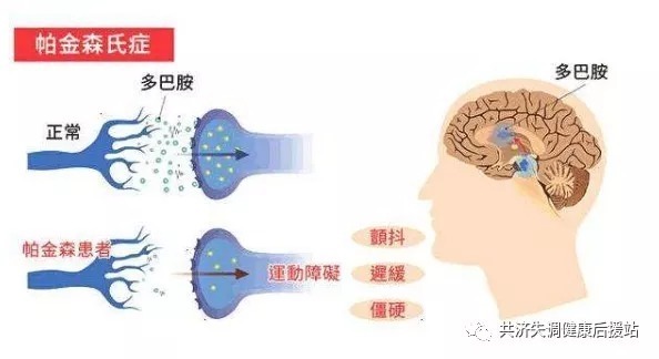 治疗方式|这些你不知道的治疗帕金森的中药材。