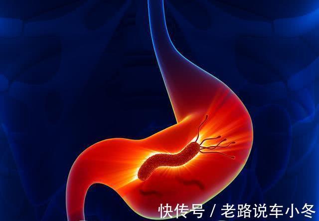 胃病|幽门螺杆菌“克星”找到了, 没事吃两口, 养胃除菌, 胃病好转不慢