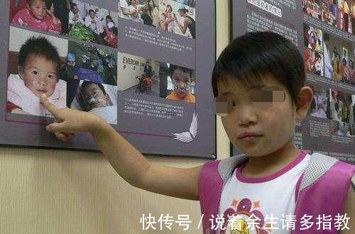 妈妈故意弄丢6岁兔唇女儿,20年后在人海中相遇,如今悔不当初