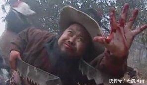 胳膊|武松被包道乙砍掉了胳膊,却死在了一个不如武松人的手里!