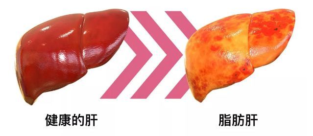 酒精|比糖和酒精更可怕的＂健康杀手＂，竟然是它！你常吃的食物中就有…