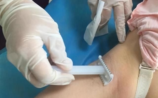 顺产|宝妈吐槽分娩时的尴尬:头胎顺产被“剃毛”,二胎剖腹产也没逃掉