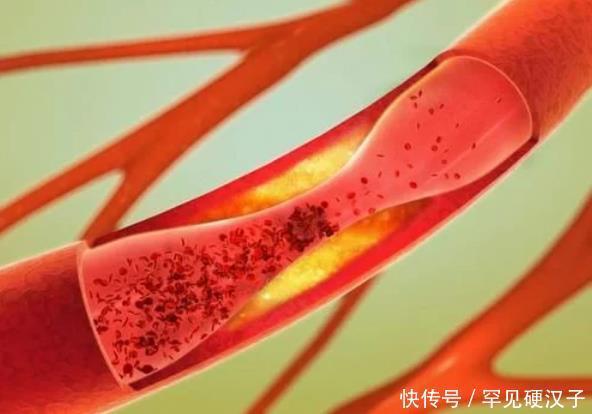 节食|空着肚子也是一种养生吗节食养生的4个好处,你了解吗