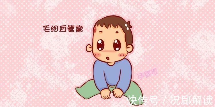 咖啡斑|怀孕期间，不想“胎记”赖上宝宝，准妈妈看完后避开这2种行为