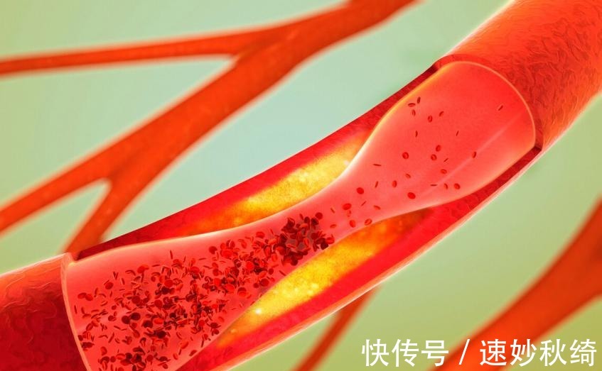 玉米|“甘油三酯天敌”就是它!中老年人群,为了血管健康尽量吃一些