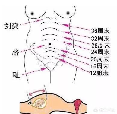 病理性原因|孕23周肚子右下方总是隐隐作痛，这是什么问题呢？