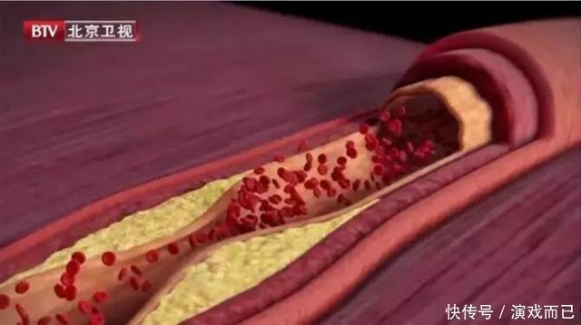 海带是个宝,常吃清脂、控压、还健脑但有个部位最好别碰