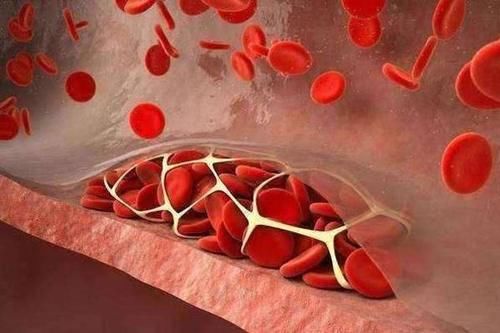 血脂|每天喝牛奶，对高血脂有什么影响？血脂高的人，医生建议了解下