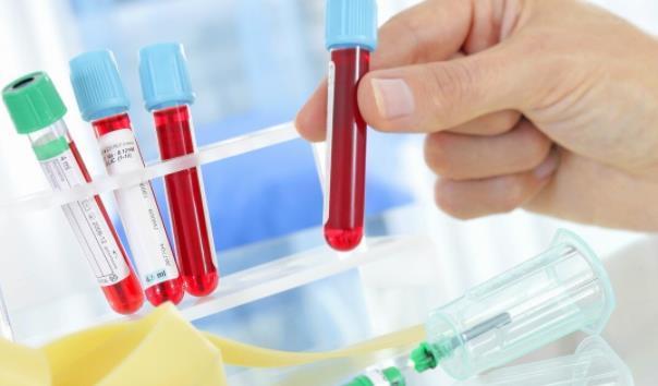 血液粘稠|血液粘稠了会有哪些异常？走好“三步”血液恢复顺畅