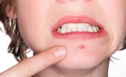 果说|女人有没有妇科病,看嘴就能明白,若有表现,十有八九是找上你了