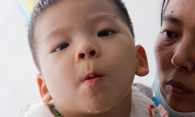 儿子|男童出生因缺氧致脑出血,8个月大被确诊脑瘫,每天只睡2小时