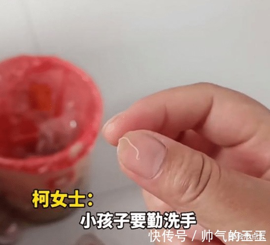女童|2岁女童眼中取出3条白虫,妈妈误以为是眼屎,吓得不轻