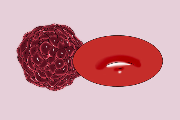 营养均衡|女子肺癌7年,两次发生转移,都死里逃生,她的抗癌方法值得学习