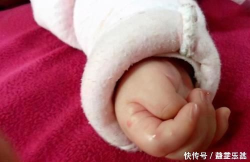 出生率|宝宝拇指内扣,大脑会很笨?超过这个月龄没好转,就该及时就医