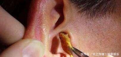 小凌|7岁男童总说耳朵痒,妈妈用手电筒一看,身上的鸡皮疙瘩都起来了