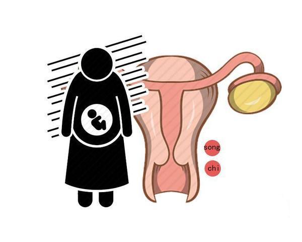 失眠|一怀孕总是睡不好?或许是3个原因在“捣鬼”!劝你做好3件事