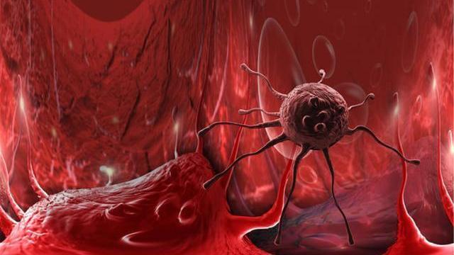 生长激素|锻炼不完全等于健康!提醒你,4件麻烦事会不请自来