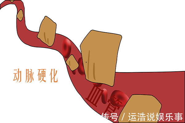 降血压|吃水煮蛋,是升血压,还是降血压?本文说清早餐吃蛋的好坏