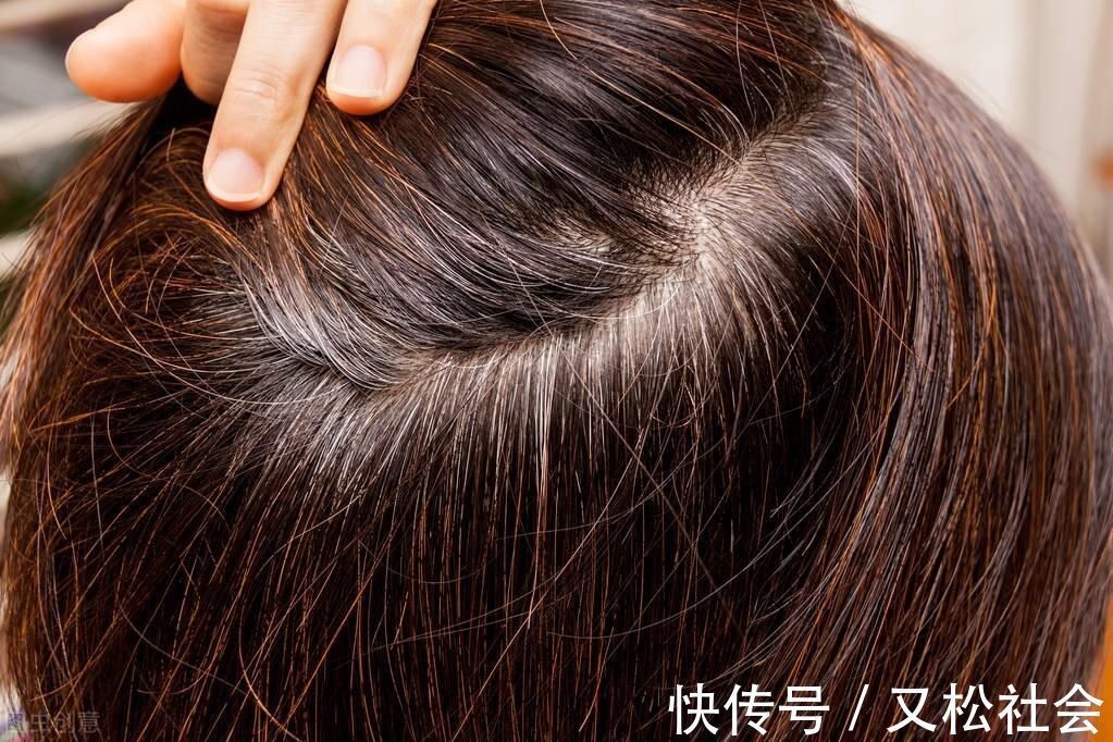 40多岁白发明显 拔不干净又怕染发不安全 怎么办 粉紫色 40多岁白发明显 拔不干净又怕染发不安全 怎么办 粉紫色