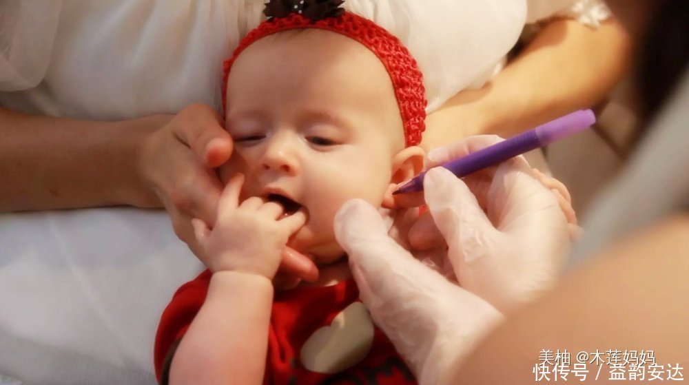 耳钉|为什么不建议家长给孩子打耳洞?专业医生表示:要去正规的医院