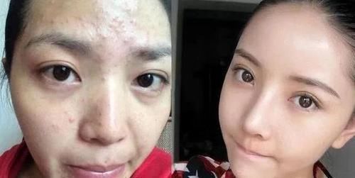 长期素颜和每天化妆的女人，坚持10年后，皮肤差异巨大