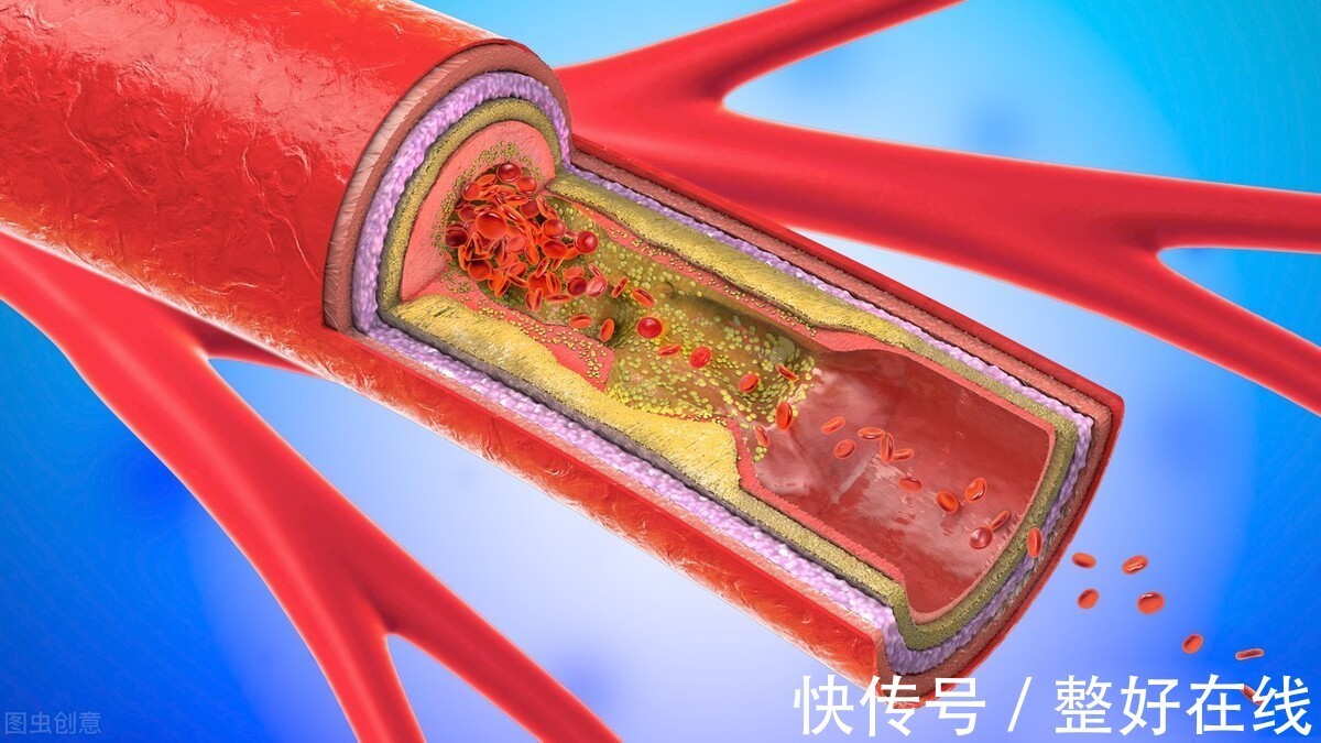 长期睡眠|糖尿病很有可能是“睡”出来的,3种方式容易惹上糖尿病,要注意