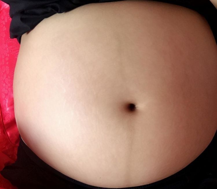 准妈妈|准妈妈肚皮被“盯上了”,孕肚的几个特点,跟胎宝性别有关吗?