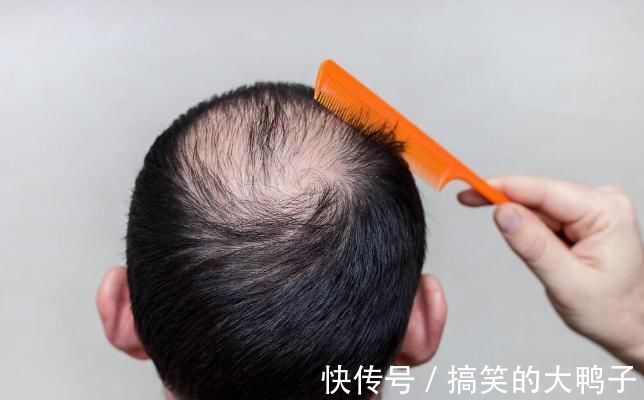 癌症|治疗癌症采用放疗很常见,关于5个副作用要牢记,早知道早作准备