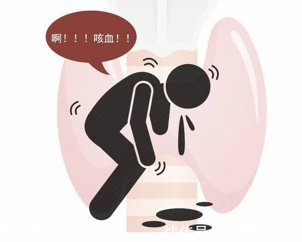 恶性|甲状腺癌是“善良癌”，恶性程度低，发展速度慢，但发现后早处理