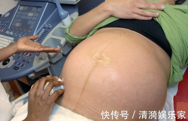 产检|前几次产检没问题,孕晚期却查出胎儿畸形,过了这个阶段才能放心